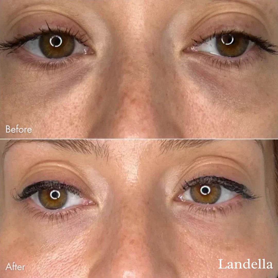 MikroAufnäher™ Entfeuchten und aufhellen