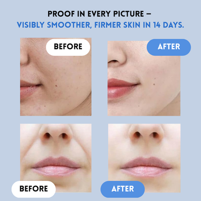 JugendLifting™ Sofortiges Jugendliches Lifting