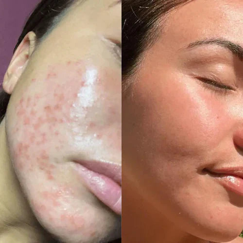 LumiGlow™ - Schmerzfreie Behandlung: Nicht-invasive Therapie