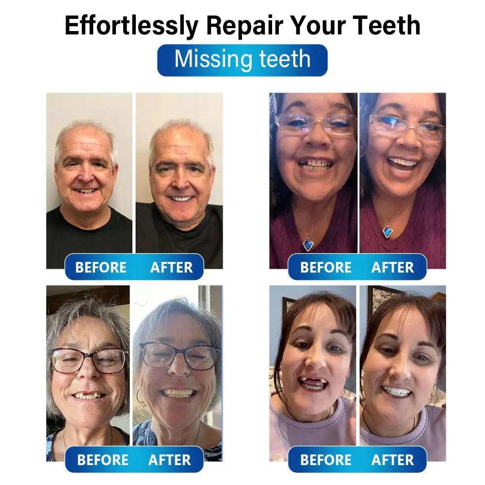 Futusly™ - Blau-Licht Aushärtungsgerät und Zahnprothesenmaterialien