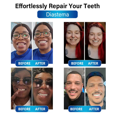 Futusly™ - Blau-Licht Aushärtungsgerät und Zahnprothesenmaterialien