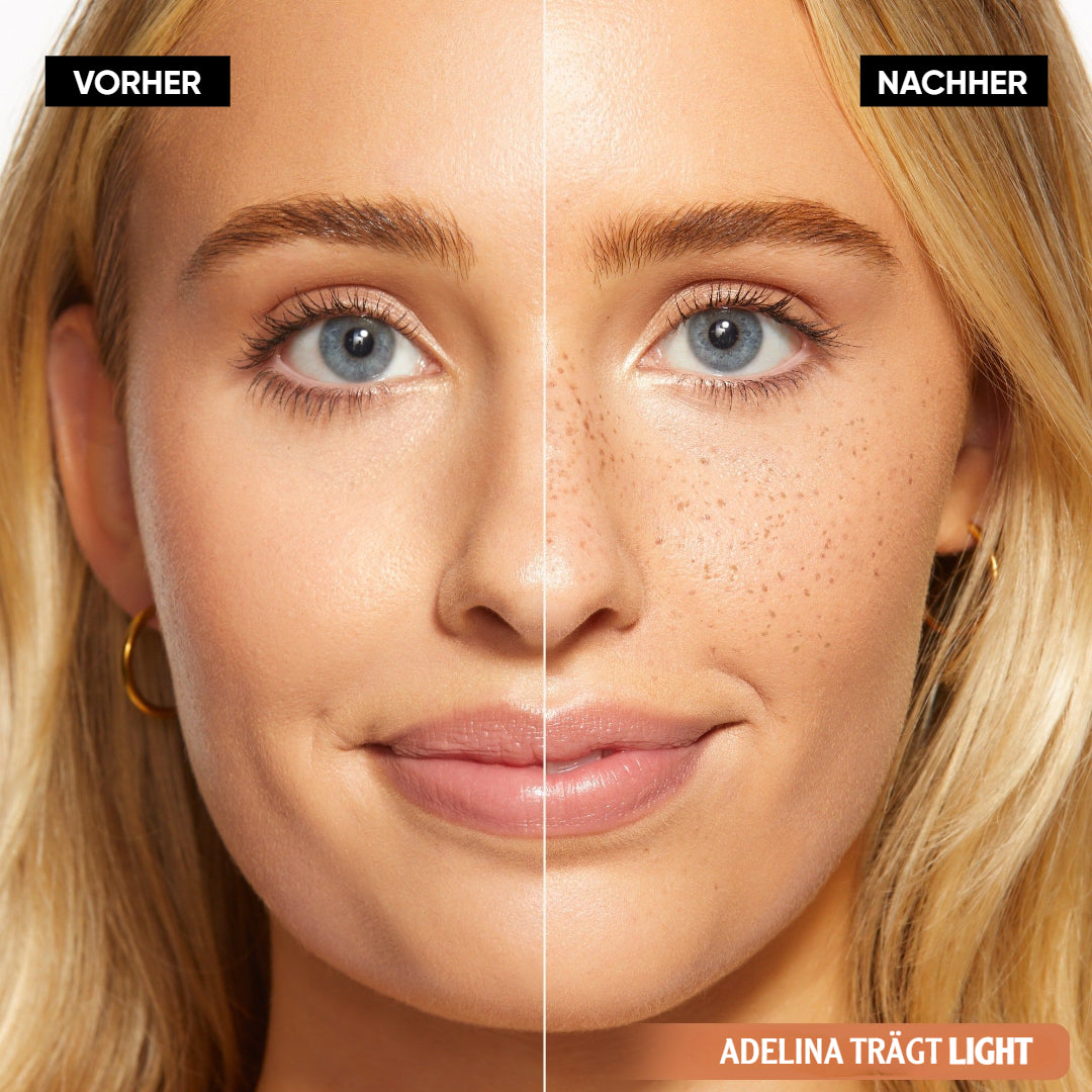 SonnenPunkte™ Verspielter Beauty-Akzent